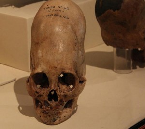 Peruvian skull